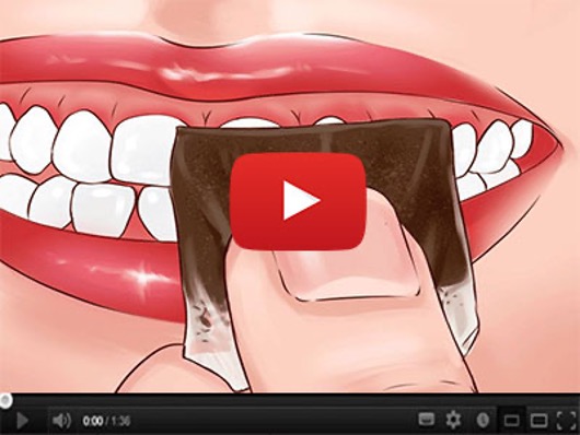 Watch this short video and see how to correctly use this mineral volcanic clay to fix and even reverse tooth decay, no matter how advanced!