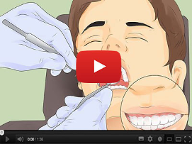 Dentists Say This Cheap “Thermal” Calcium Works Better Than Implants